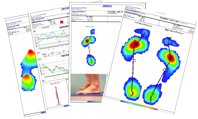 Πελματογράφημα Footworkinsoles