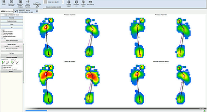 Εικόνα πελματογραφήματος